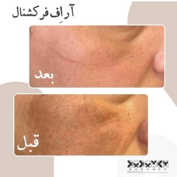 WhatsApp Image 2023-12-24 at 10.41.42