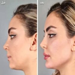 ba6ee0e2-e55e-4f4d-95f8-3f1a5a1bb66b