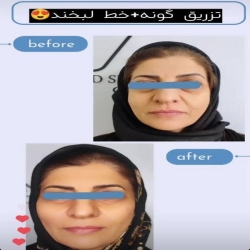 e82a04f8-1ae4-45df-9317-2049a62c5696